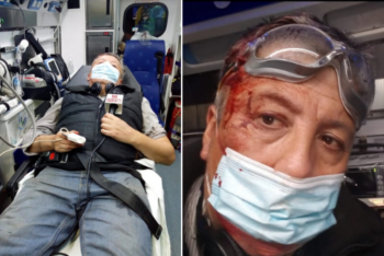 Francisco Burgos (Mas Valdivia TV, Chile): socorrido com corte na cabeça. Foto: cortesia