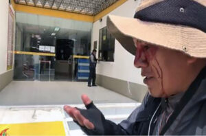 O fotojornalista do jornal La Razón de La Paz, Miguel Carrasco, aparece com o rosto ensanguentado após receber uma pedra durante o conflito pós-eleitoral de 20 de outubro de 2019, na Bolívia.