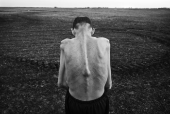 Man facing away, his spine showing through his skin